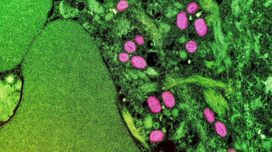 Aufnahme von Partikeln des Affenpockenvirus