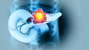 Illustration der Bauchspeicheldrüse