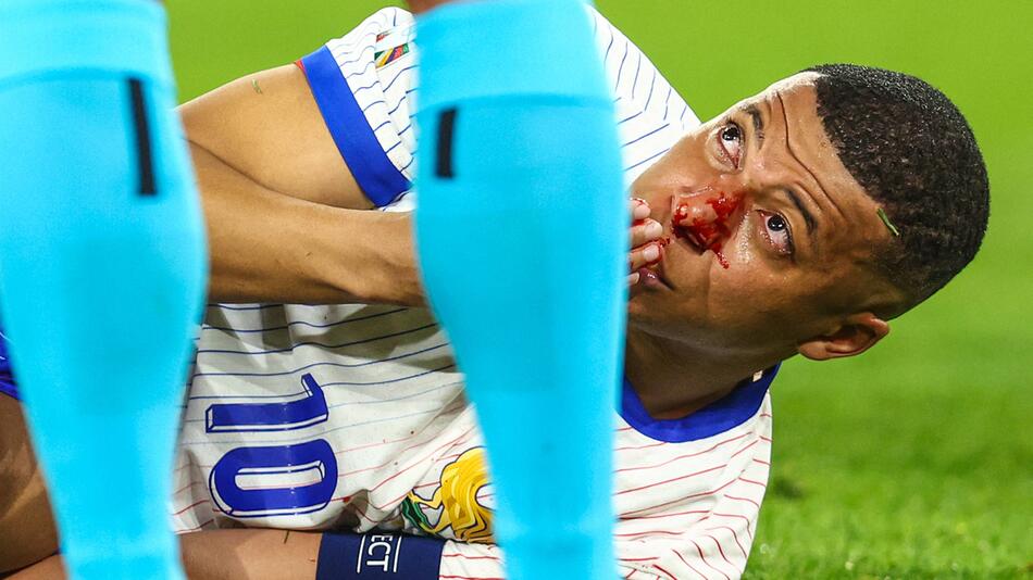 Kylian Mbappe hat sich die Nase gesprochen.