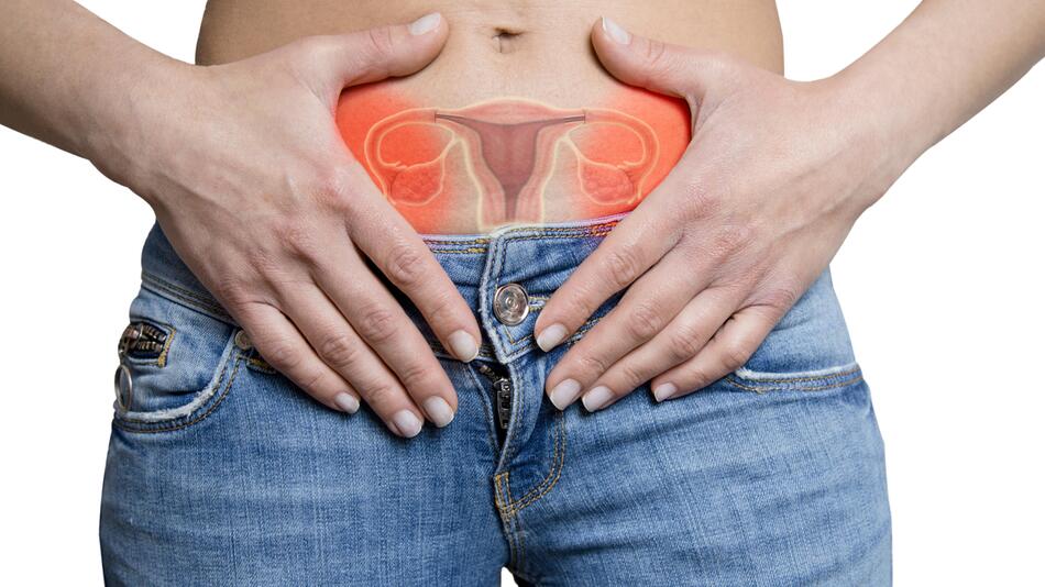 Häufige Hormonstörung bekommt neuen Namen – was Betroffene wissen müssen
