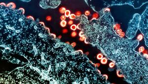 HIV Virus