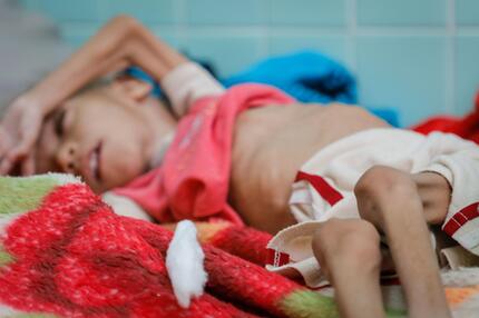 Jemen, Hunger, Krieg, Ernährung, UN