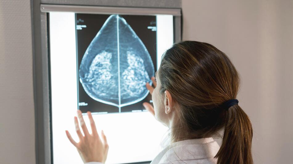 Adipositas-OP senkt laut Studie das Risiko für mehrere Krebsarten