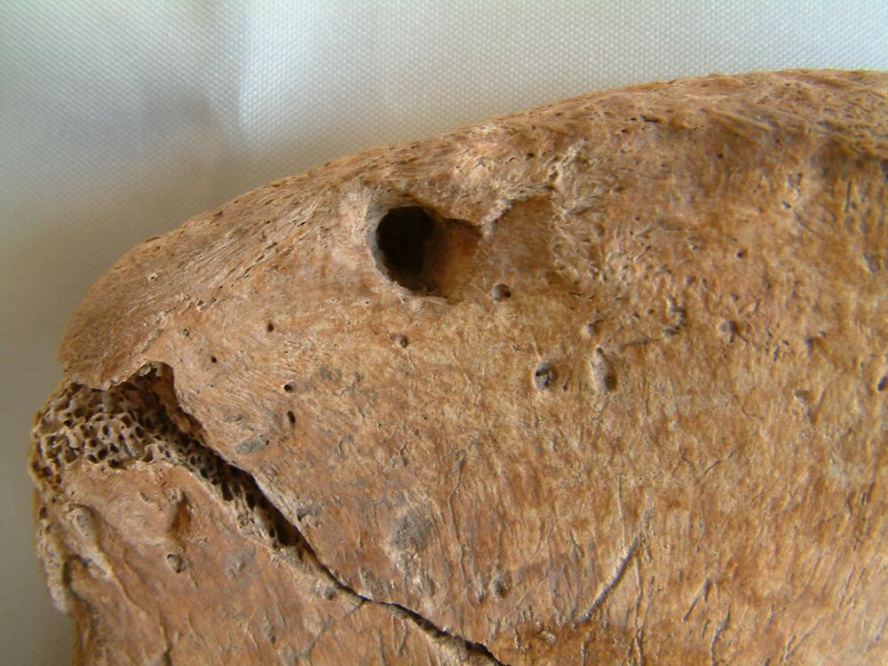 Bissspuren einer Großkatze auf einem Hüftknochen