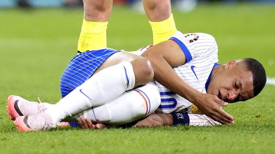Kylian Mbappé erlitt im ersten EM-Spiel gegen Österreich einen Nasenbeinbruch.