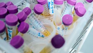 Spuren eines Weichmachers in Urin nachgewiesen