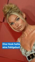 Elsa Hosk spricht über Familienplanung und persönliche Erfahrungen