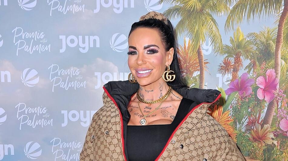 Gina-Lisa Lohfink verzweifelt: "Ich habe Angst, mein Bein zu verlieren"