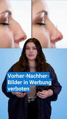 Verboten? Vorher-Nachher-Bilder von Beauty-Eingriffen