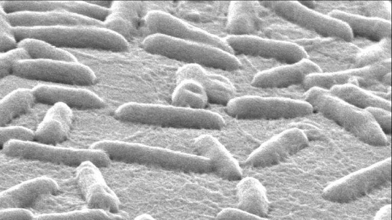 Warum manche Antibiotika plötzlich ihre Wirkung verlieren