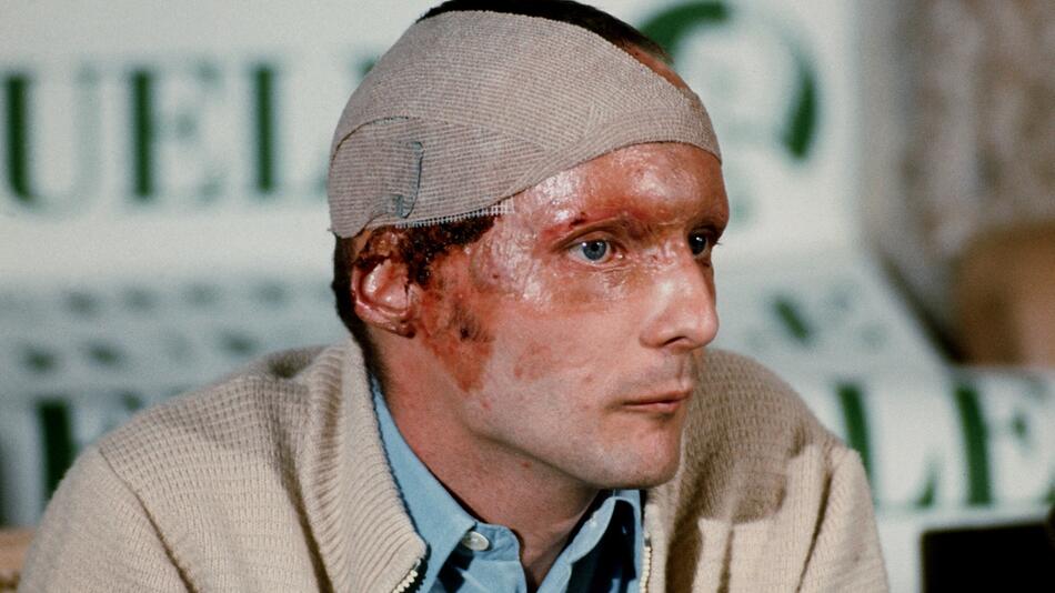 Der Unfall, der Niki Laudas Leben veränderte