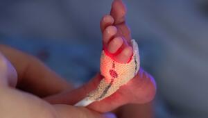 Darmkeim-Infektionen in Kinderklinik: Frühchen gestorben